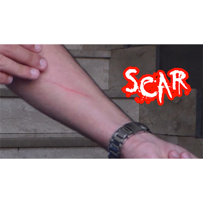 SCAR by Dan Alex - Video DOWNLOAD